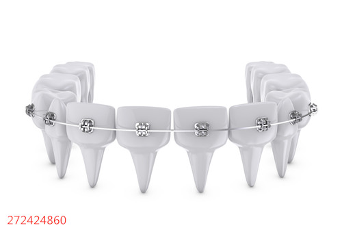 牙齿正畸期间，该怎么进行护理最有效呢？