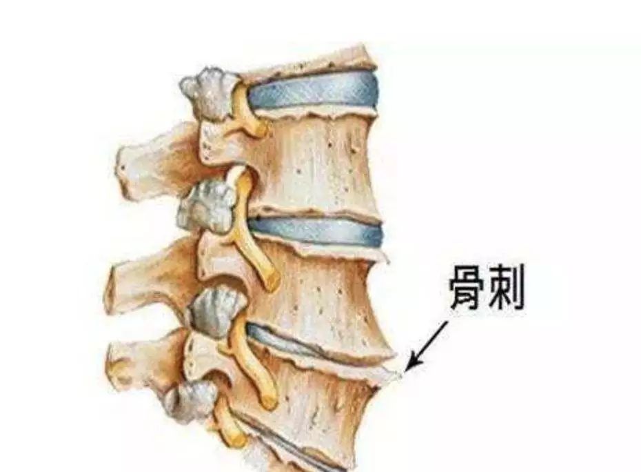 这十件生活中较常见的事情，正在伤害你的腰！