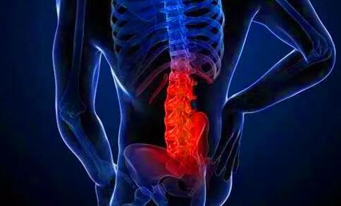 强直性脊柱炎有哪些症状?不早做预防，可能会有残疾的“危险”