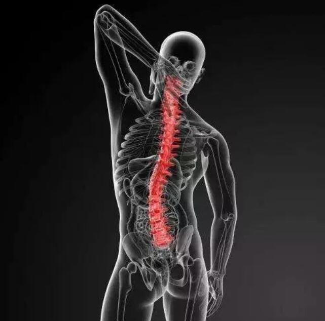 强直性脊柱炎患者的“晨僵”现象和应对措施
