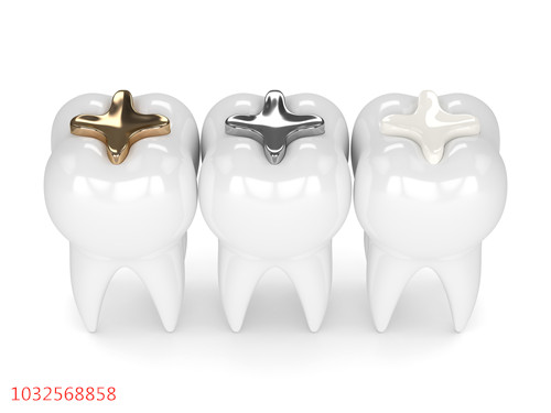缺牙和补牙的五大坑，看看你中了几个？