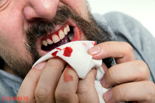 牙龈出血的五大解决技巧，快来学学看
