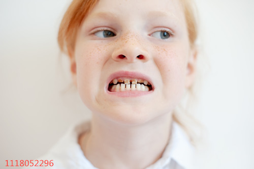 牙齿畸形的六大危害，你确定不来看看？