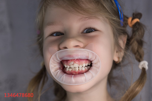 和孩童牙齿矫正的区别，了解一下？