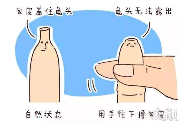 割包皮的好