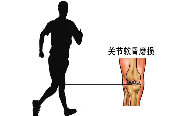 膝关节疼痛缩减关节使用寿命？医生：做好3点，膝关节不疼不肿 