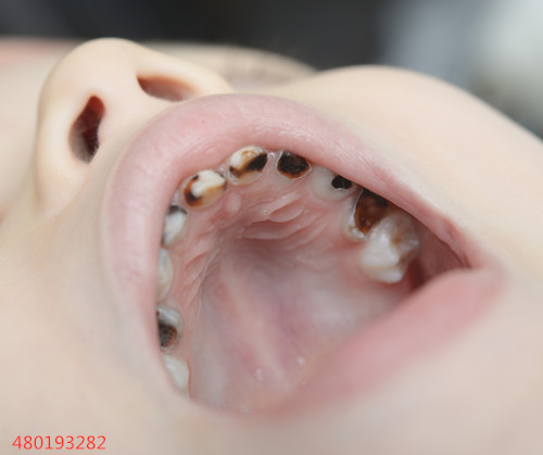 牙齿稀疏有利于宝宝的恒牙萌出吗?戳进来看看