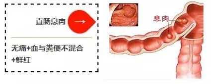  排便难、次数少、便干，这该怎么办