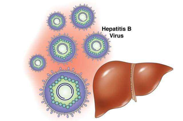乙肝细菌都有哪些症状？成都华西告诉你大三阳早期症状