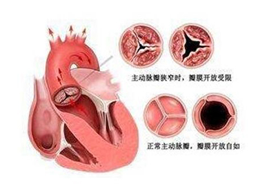 胸口出现疼痛？可能和这些问题有关