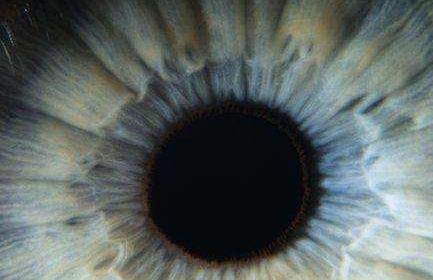  角膜怎么变薄了呢？是什么导致眼角膜变薄的？