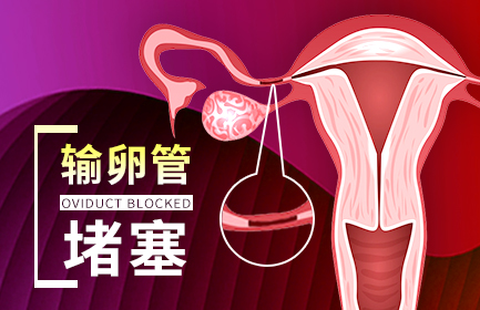 引起女性输卵管堵塞的原因有哪些？这些你了解吗？