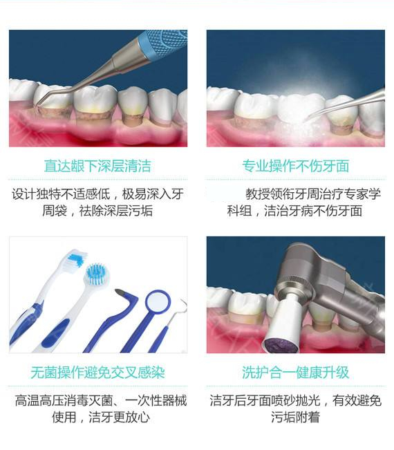 洗牙有必要吗？为什么要洗牙？