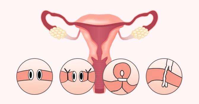 输卵管堵塞患者的症状有哪些？