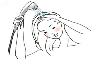 植发后，几天能洗头？