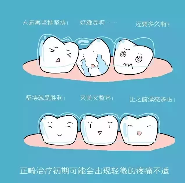 关于牙齿矫正，没有误解就没有犹豫