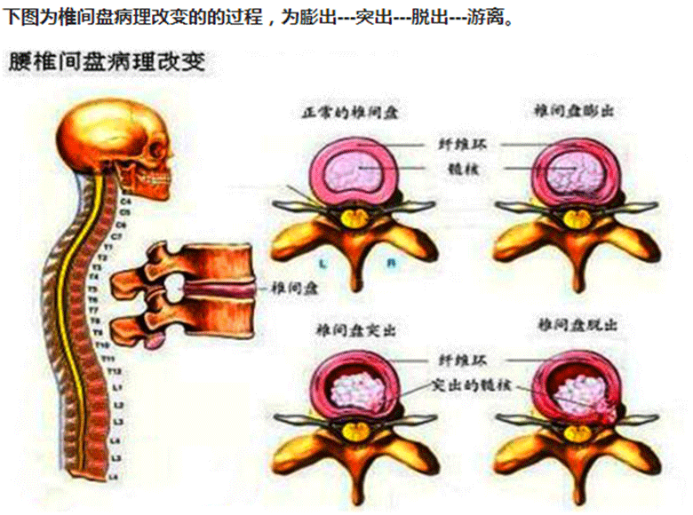 生活中要注意时常会腰疼的情况 一起来看看