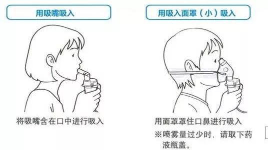 哮喘、咳嗽、支气管炎？来看看雾化科普知识~