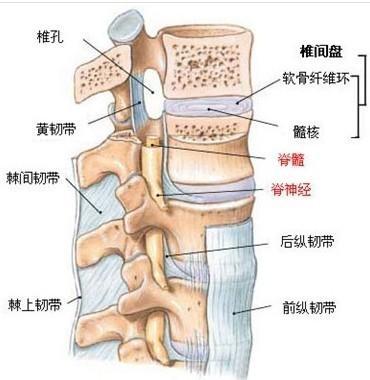 腰间盘突出的禁忌