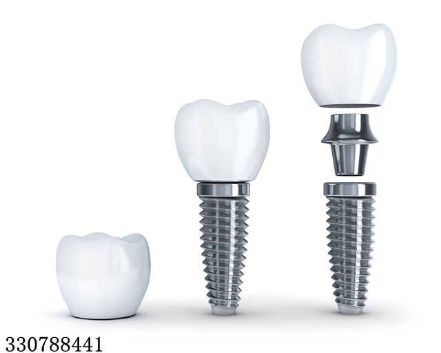 牙齿修复有几种方法？你选择对了吗？
