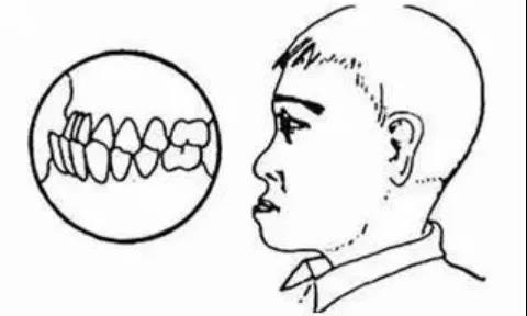 12岁才可以开始矫正的观念，到底耽误了多少孩子？