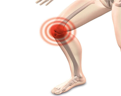 引起膝关节炎的主要因素是什么?对此你有哪些了解呢?