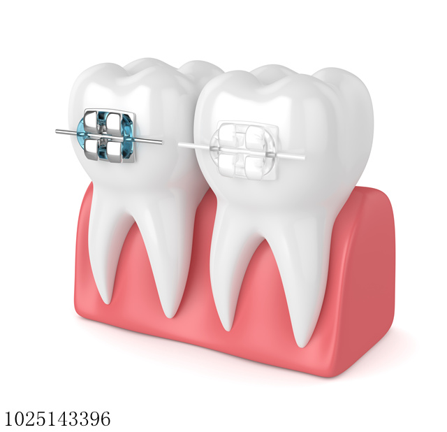 关于牙齿矫正的误区，你知道多少吗？