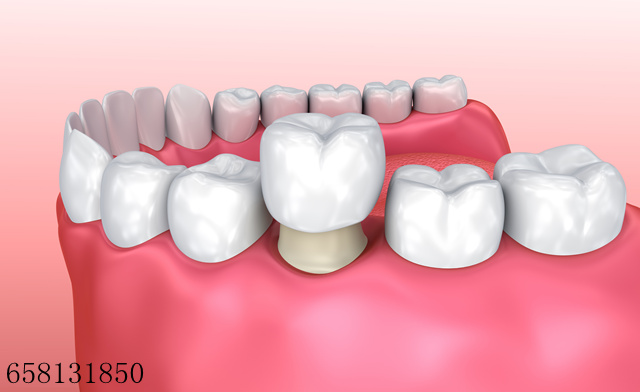 门牙掉了怎么办？要如何修复呢？