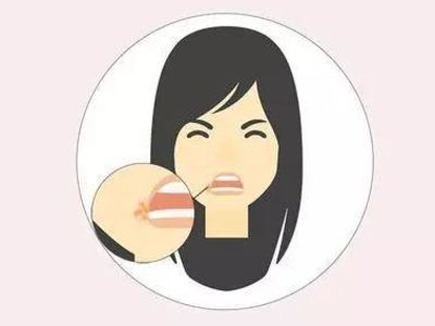 口腔科刘海云医生：导致口角炎的原因是什么？