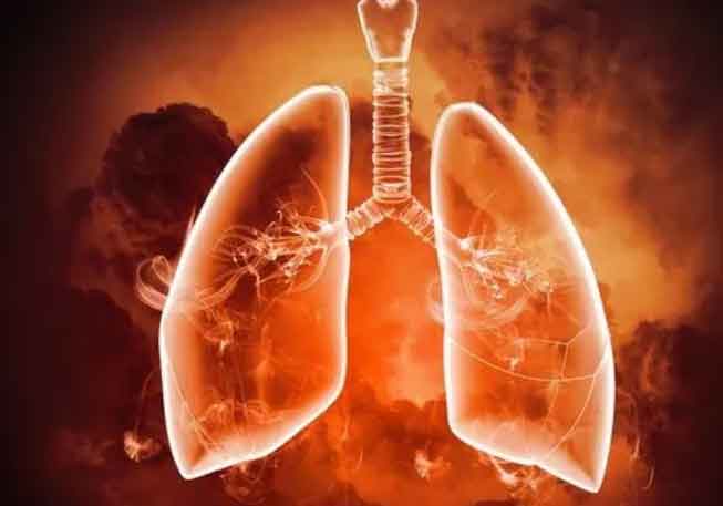 肺气肿患者如何自己判断自己病情的严重程度？