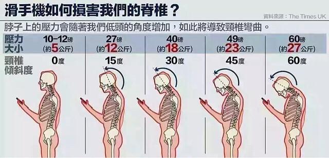 脖子疼、颈椎病，平时保养也很重要，关注这些、预防颈椎病 