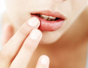 口角炎对于大家而言并不陌生,但是口角炎的原因有哪些