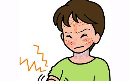冬季不可不防的皮肤病 接触性皮炎