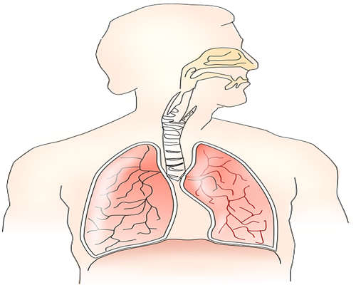 诱发肺癌的原因有哪些？治疗肺癌也需要营养支撑，不要忘了多维护