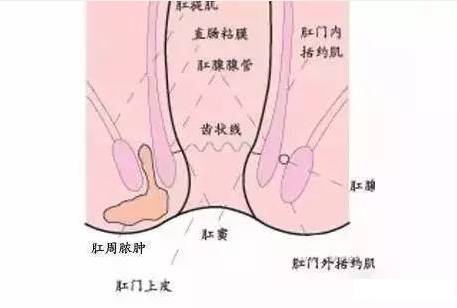 肛肠疾病别扛着，这六种症状一定要去医院！