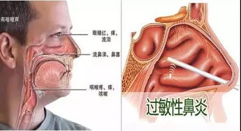 北京哪个医院看鼻子好