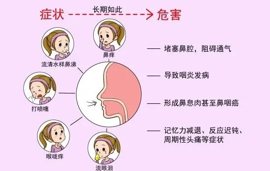 季节性过敏性鼻炎如何应对