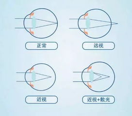 北京那家眼科医院好