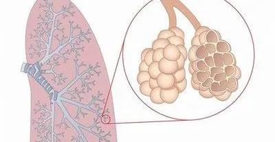 肺气肿不及时治疗，3大并发症可致命