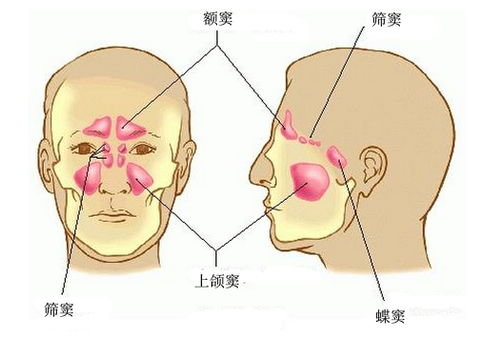 北京鼻窦炎手术多少钱