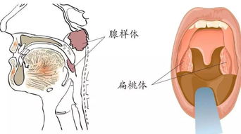 北京那家医院看打呼噜好