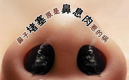 北京鼻息肉手术需要多少钱