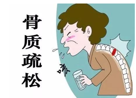 骨质疏松，不止是补钙