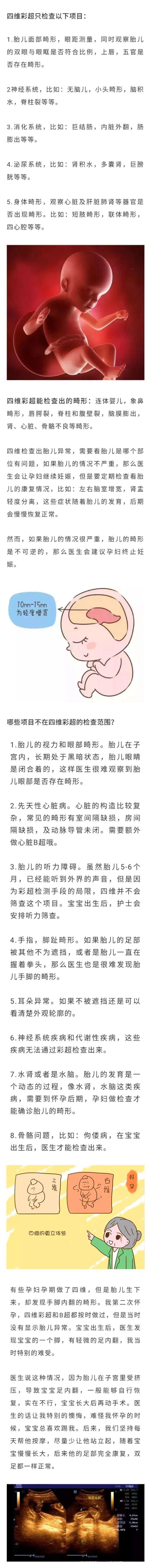  关于四维彩超的那些事，你有必要get一下