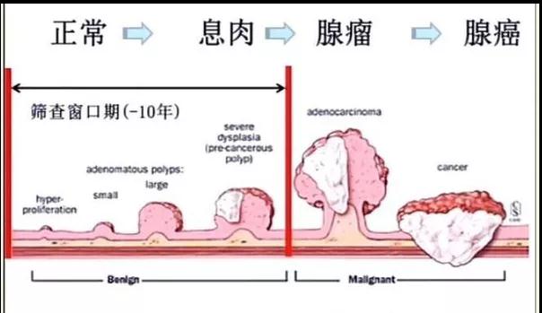 息肉之惑——结直肠息肉高频问答