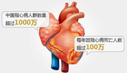 胸痛胸闷怎样判别是不是冠心病？