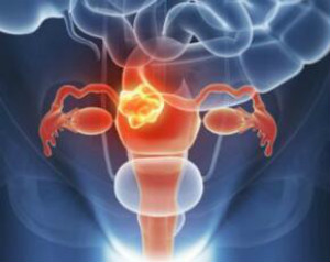 防止卵巢早衰的妙招都有哪些?如何做好养生呢?