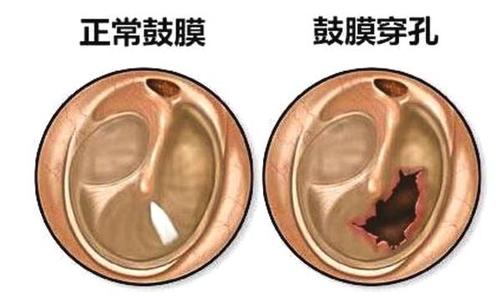 看耳朵北京哪家医院好