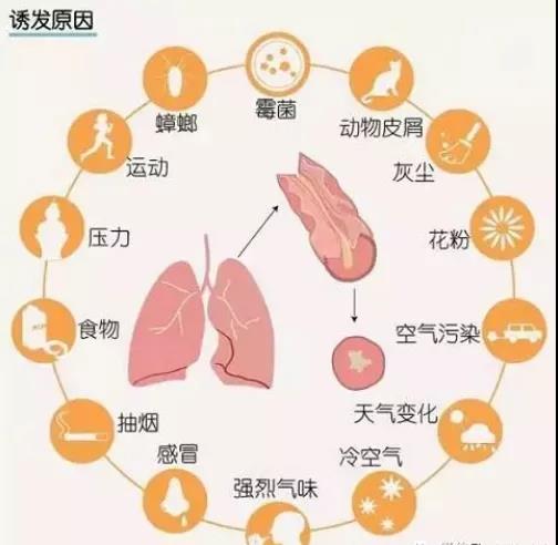 【疾病科普】哮喘是怎么回事？为什么会致命呢？