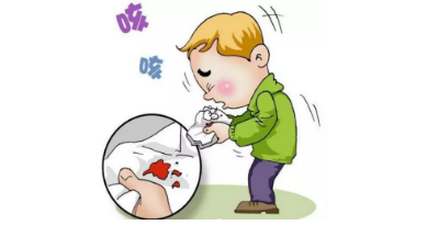 注意：支气管扩张患者需要满足以下三种情况才能动手术！